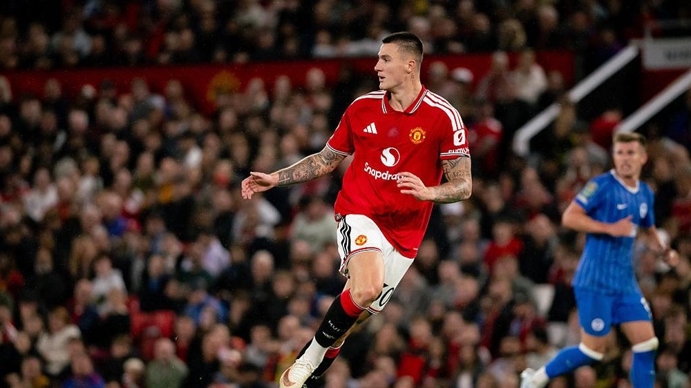 Sesko Terkapar Lagi! Misi Comeback Dimulai, Man Utd Was-was?